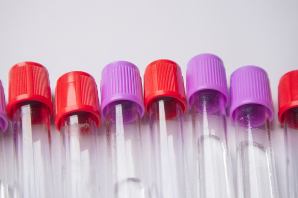 A line of test tubes lays on a white background. The tubes have red and purple tops.