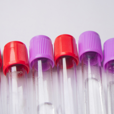 Test tubes with brightly colored caps lay on a white background.