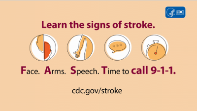 photos of stroke symptoms including face, arms, speech and time to call 911
