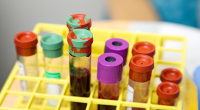 vials of blood in laboratory setting